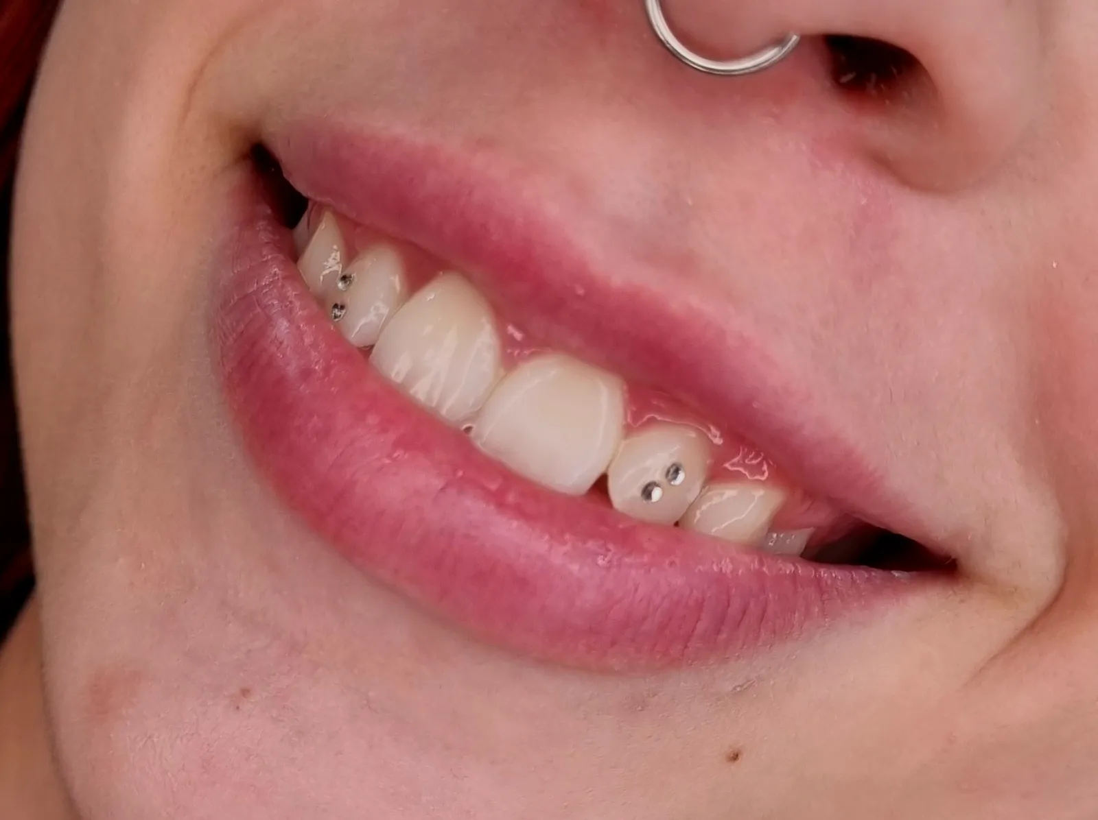 Joyería dental